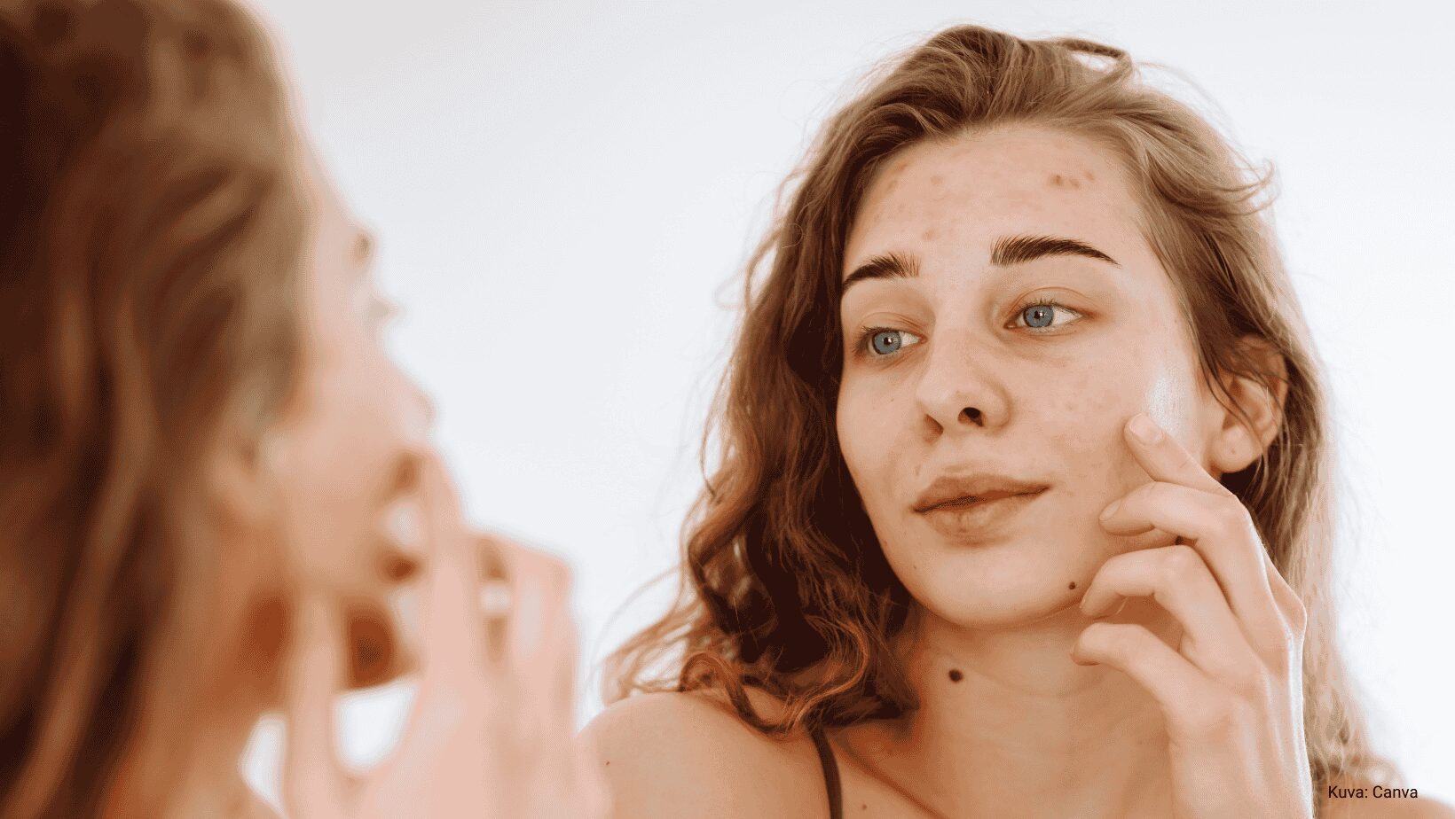 Rasvaisen ihon hoito vaatii säännöllisyyttä. Tutustu artikkeliin.